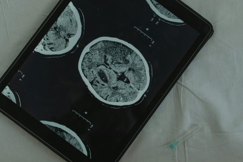 ALA e ruolo neuroprotettivo